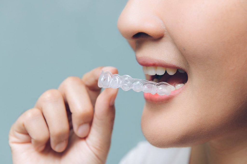 Woman putting in aligners from Sweet Tooth Smiles in Richmond and Memorial, Texas.